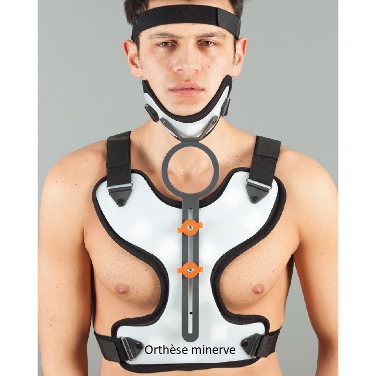 ORTHESE MINERVE