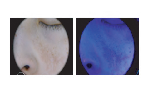 LAMPE DIAGNOSTIQUE POUR DERMATOLOGIE -LED-et-UV- – Image 2